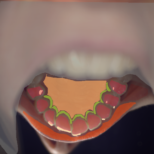 False color image render of a spectral image exhibiting enamel, hard palate, lip, marginal gingiva, oral mucosa, out of focus area and specular reflection