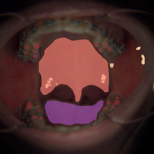 False color image render of a spectral image exhibiting enamel, oral mucosa, soft palate, specular reflection and tongue