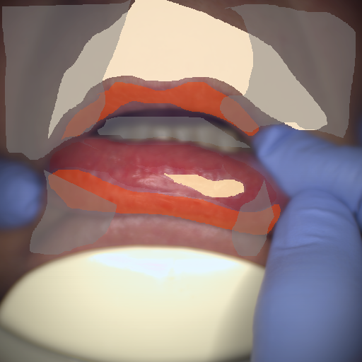 False color image render of a spectral image exhibiting lip, oral mucosa, out of focus area, skin and specular reflection