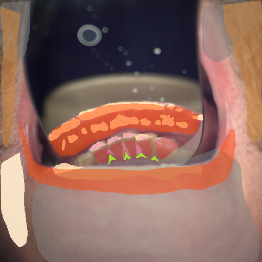 False color image render of a spectral image exhibiting attrition/erosion, calculus, enamel, gingivitis, hair, lip, out of focus area, skin and specular reflection