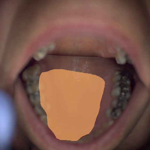 False color image render of a spectral image exhibiting  and hard palate