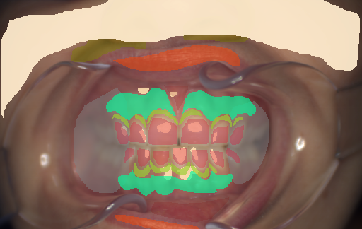 False color image render of a spectral image exhibiting attached gingiva, enamel, lip, marginal gingiva, oral mucosa, out of focus area, shadow/noise, skin and specular reflection