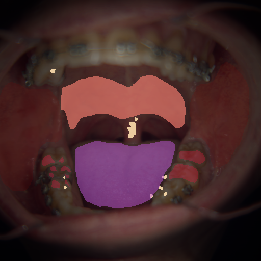 False color image render of a spectral image exhibiting enamel, oral mucosa, soft palate, specular reflection and tongue