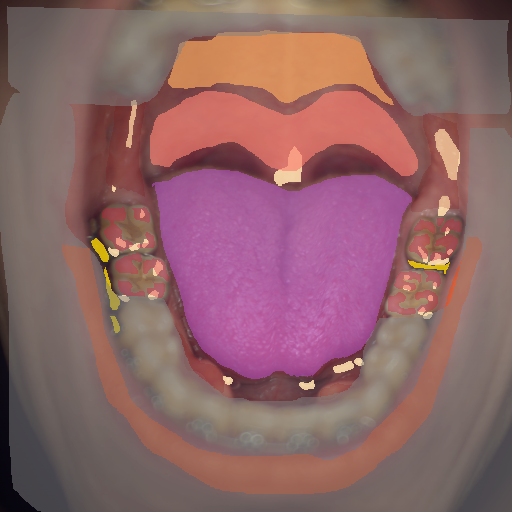 False color image render of a spectral image exhibiting enamel, hard palate, lip, metal, oral mucosa, out of focus area, soft palate, specular reflection, stain and tongue