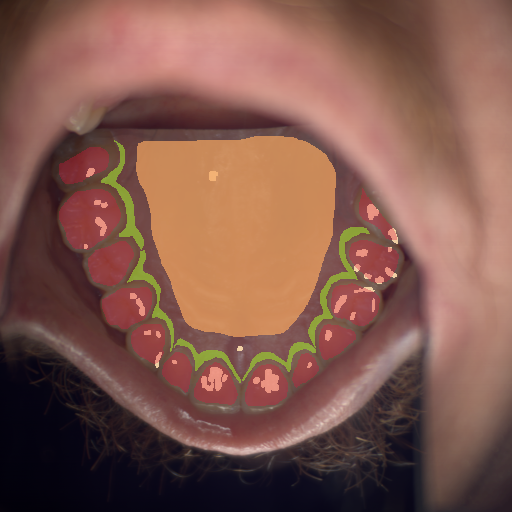 False color image render of a spectral image exhibiting enamel, hard palate, marginal gingiva and specular reflection