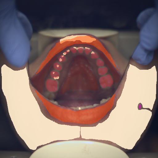 False color image render of a spectral image exhibiting enamel, lip, mole, oral mucosa, skin and specular reflection