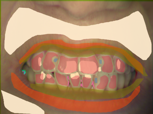 False color image render of a spectral image exhibiting calculus, enamel, lip, plastic, shadow/noise, skin and specular reflection