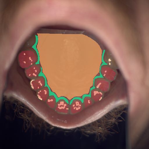 False color image render of a spectral image exhibiting attached gingiva, enamel, hard palate and specular reflection