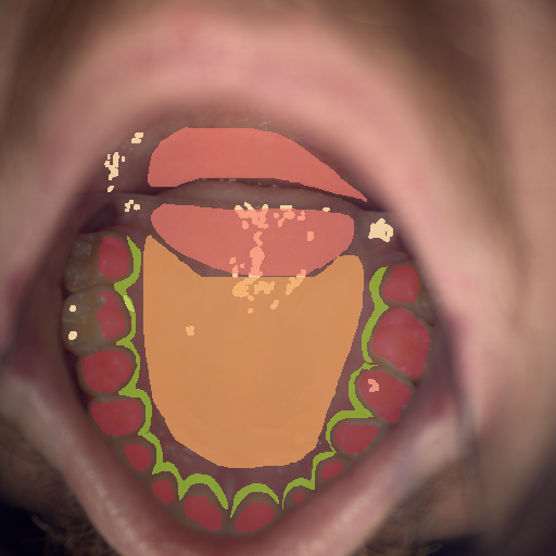 False color image render of a spectral image exhibiting enamel, hard palate, marginal gingiva, soft palate and specular reflection