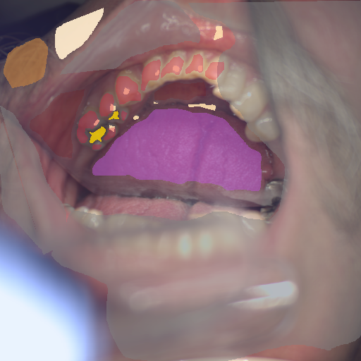 False color image render of a spectral image exhibiting enamel, hair, metal, oral mucosa, out of focus area, skin, specular reflection and tongue