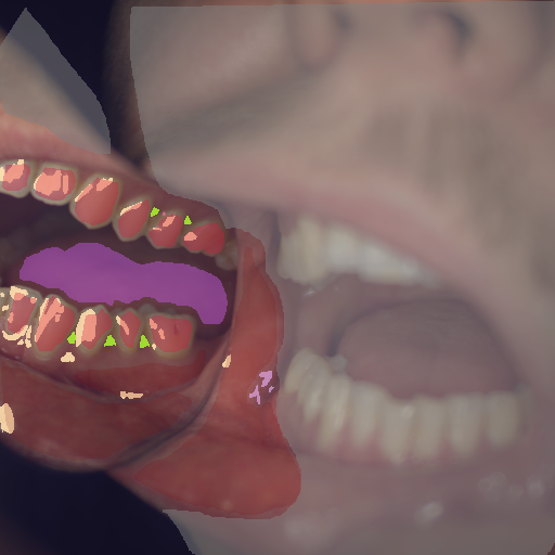 False color image render of a spectral image exhibiting calculus, enamel, gingivitis, leukoplakia, oral mucosa, out of focus area, specular reflection, stain and tongue