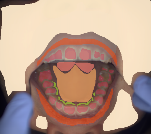 False color image render of a spectral image exhibiting enamel, hard palate, lip, marginal gingiva, out of focus area, shadow/noise, skin, soft palate and specular reflection