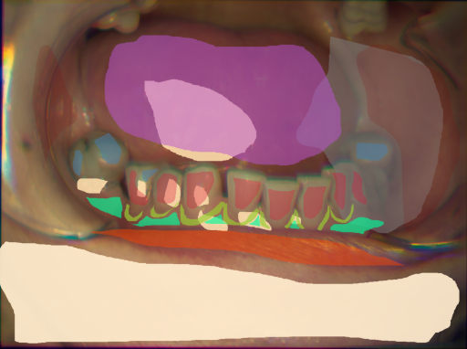 False color image render of a spectral image exhibiting attached gingiva, enamel, lip, marginal gingiva, oral mucosa, out of focus area, plastic, skin, specular reflection, stain and tongue