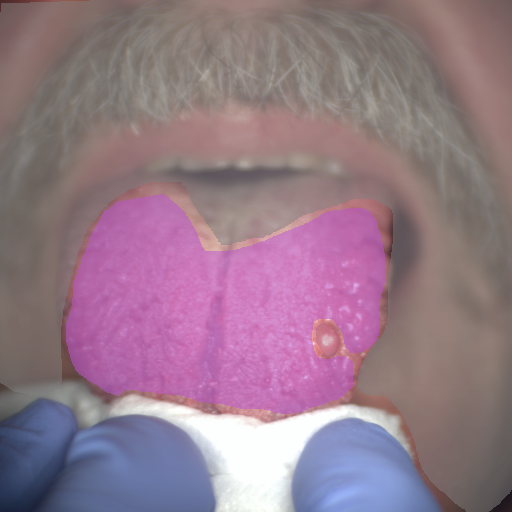 False color image render of a spectral image exhibiting fibroma, out of focus area and tongue