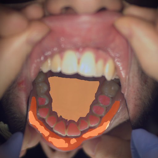 False color image render of a spectral image exhibiting enamel, hard palate, lip and specular reflection