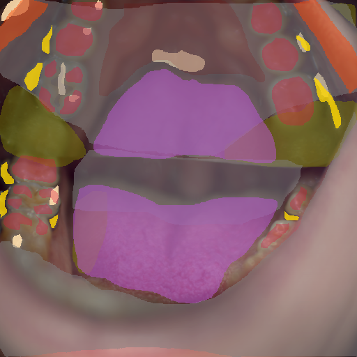 False color image render of a spectral image exhibiting enamel, lip, metal, oral mucosa, out of focus area, shadow/noise, specular reflection, stain and tongue