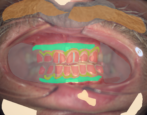 False color image render of a spectral image exhibiting attached gingiva, enamel, hair, marginal gingiva, microfracture, oral mucosa, out of focus area, skin and specular reflection